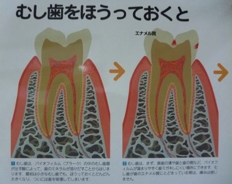 asakawakonchi02
