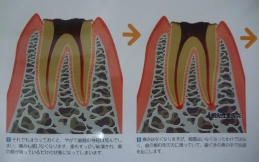 asakawakonchi04