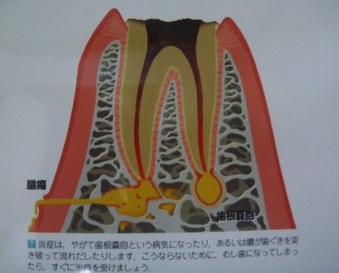 asakawakonchi05